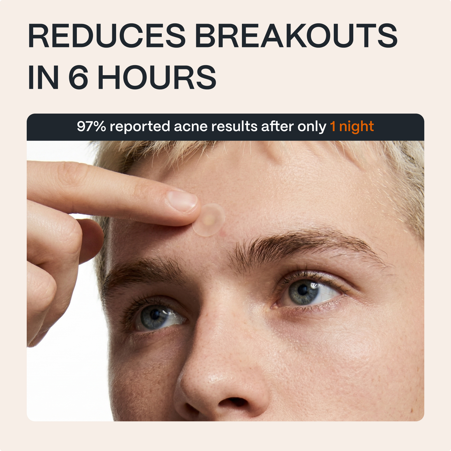 Man wearing a acne patch on his forehead beside a 6-hour results graphic