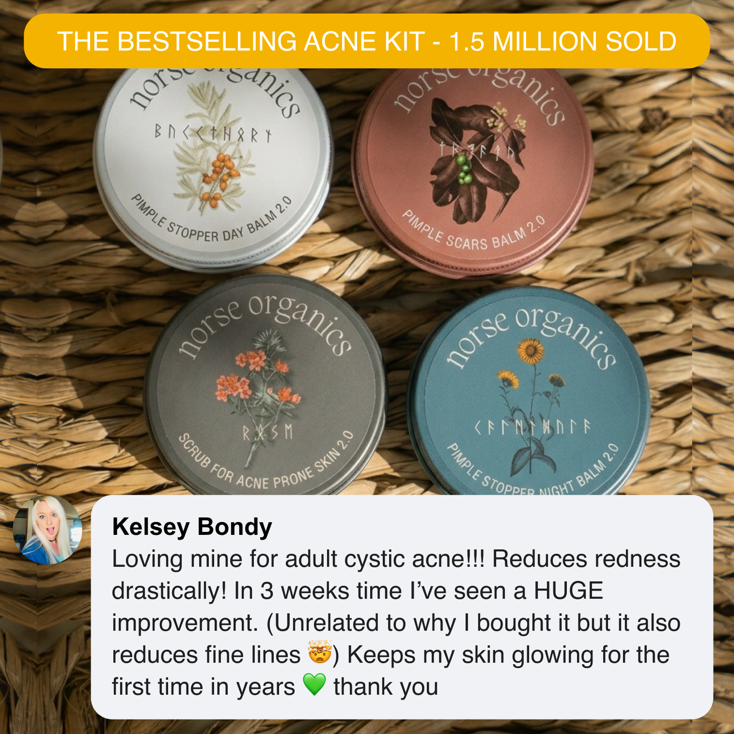 Four Complete Acne Killer System 2.0 jars with a bestseller badge and a customer testimonial