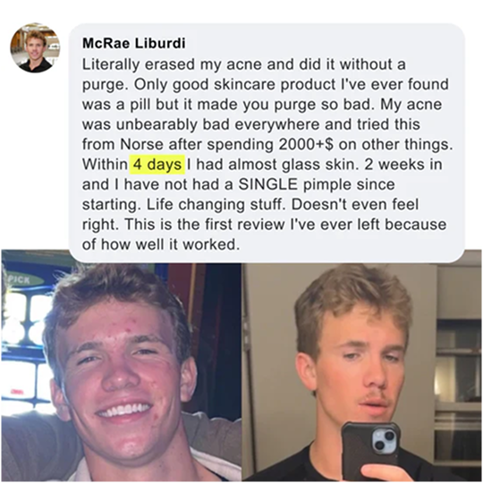 Skin transformation before and after