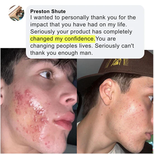 Skin transformation before and after