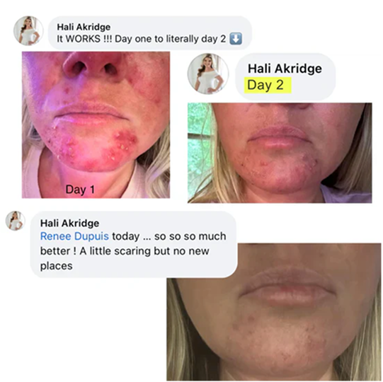 Skin transformation before and after