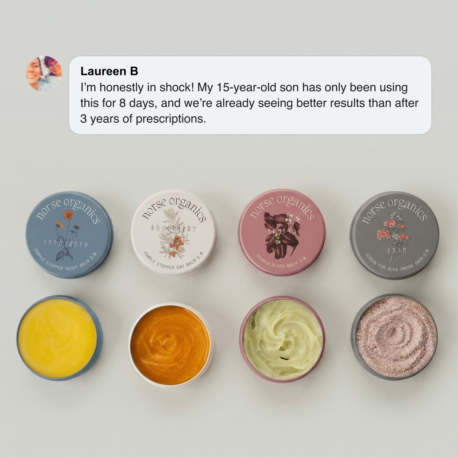 Four open Complete Acne Killer System 2.0 jars with a parent testimonial about clearer skin