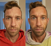 Before and After